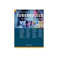 Tuberkulóza ve faktech i obrazech