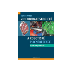 Videotorakoskopické a robotické plicní resekce - Praktický manuál Videotorakoskopické a robotické plicní resekce - Praktický manuál