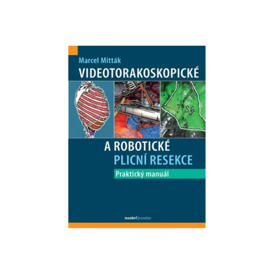 Videotorakoskopické a robotické plicní resekce - Praktický manuál